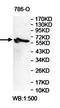 Zinc Finger Protein 285 antibody, orb78062, Biorbyt, Western Blot image 