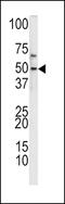 Kruppel Like Factor 11 antibody, MBS9200991, MyBioSource, Western Blot image 