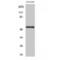 Tachykinin Receptor 3 antibody, LS-C384908, Lifespan Biosciences, Western Blot image 