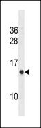 Membrane Spanning 4-Domains A13 antibody, PA5-49220, Invitrogen Antibodies, Western Blot image 