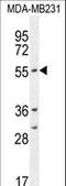 Cytochrome P450 Family 2 Subfamily A Member 7 antibody, LS-C167219, Lifespan Biosciences, Western Blot image 