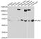 Perilipin 2 antibody, STJ28198, St John