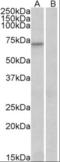 Forkhead Box O3 antibody, orb18806, Biorbyt, Western Blot image 