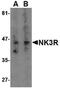Tachykinin Receptor 3 antibody, LS-C34712, Lifespan Biosciences, Western Blot image 