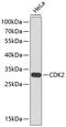 Cyclin Dependent Kinase 2 antibody, 18-648, ProSci, Western Blot image 