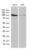 Karyopherin Subunit Beta 1 antibody, LS-C796053, Lifespan Biosciences, Western Blot image 