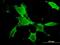 P21 (RAC1) Activated Kinase 3 antibody, H00005063-M08, Novus Biologicals, Immunofluorescence image 