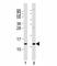 C-X-C Motif Chemokine Ligand 12 antibody, F53393-0.4ML, NSJ Bioreagents, Western Blot image 