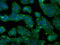 Cytochrome P450 Oxidoreductase antibody, GTX83854, GeneTex, Immunofluorescence image 