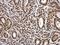 Proteasome activator complex subunit 3 antibody, GTX106722, GeneTex, Immunohistochemistry paraffin image 