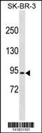 COP1 E3 Ubiquitin Ligase antibody, 60-789, ProSci, Western Blot image 