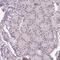UV Stimulated Scaffold Protein A antibody, HPA050824, Atlas Antibodies, Immunohistochemistry paraffin image 