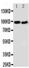 DISC1 Scaffold Protein antibody, PA2023, Boster Biological Technology, Western Blot image 