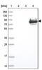 Solute Carrier Family 12 Member 4 antibody, NBP1-83067, Novus Biologicals, Western Blot image 