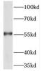 Tektin-5 antibody, FNab08590, FineTest, Western Blot image 