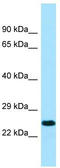 Killer Cell Immunoglobulin Like Receptor, Two Ig Domains And Long Cytoplasmic Tail 3 antibody, TA338058, Origene, Western Blot image 