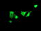 Zinc Finger And SCAN Domain Containing 18 antibody, M14039-1, Boster Biological Technology, Immunofluorescence image 