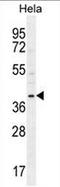 Cyclin-G1 antibody, AP50812PU-N, Origene, Western Blot image 