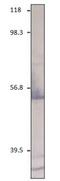 C-X-C Motif Chemokine Receptor 2 antibody, GTX14935, GeneTex, Western Blot image 