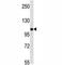 Toll Like Receptor 8 antibody, F44380-0.4ML, NSJ Bioreagents, Western Blot image 