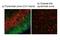 Transient Receptor Potential Cation Channel Subfamily V Member 4 antibody, ARP35330_P050, Aviva Systems Biology, Immunohistochemistry frozen image 