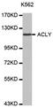 ATP Citrate Lyase antibody, abx000795, Abbexa, Western Blot image 