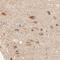 ATP Synthase F1 Subunit Delta antibody, NBP1-86162, Novus Biologicals, Immunohistochemistry paraffin image 