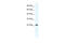 Core-Binding Factor Subunit Beta antibody, 31-149, ProSci, Western Blot image 