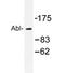 ABL Proto-Oncogene 1, Non-Receptor Tyrosine Kinase antibody, AP20341PU-N, Origene, Western Blot image 