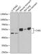 Chitinase Acidic antibody, GTX33093, GeneTex, Western Blot image 