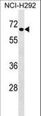 Dual Specificity Tyrosine Phosphorylation Regulated Kinase 4 antibody, LS-C167593, Lifespan Biosciences, Western Blot image 