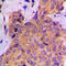 Cortactin antibody, LS-C353975, Lifespan Biosciences, Immunohistochemistry paraffin image 