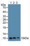 S100 Calcium Binding Protein A6 antibody, MBS2003477, MyBioSource, Western Blot image 