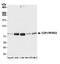 COP1 E3 Ubiquitin Ligase antibody, A300-894A, Bethyl Labs, Western Blot image 