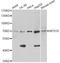 Integrator Complex Subunit 10 antibody, A13419, ABclonal Technology, Western Blot image 
