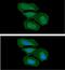 Integrin Subunit Beta 1 antibody, GTX57718, GeneTex, Immunofluorescence image 