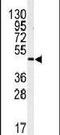 Inositol-Trisphosphate 3-Kinase A antibody, PA5-15489, Invitrogen Antibodies, Western Blot image 