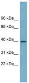 Sulfotransferase Family 2B Member 1 antibody, TA339866, Origene, Western Blot image 