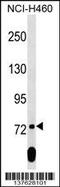 Scm Polycomb Group Protein Like 2 antibody, 59-463, ProSci, Western Blot image 