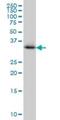 Crystallin Mu antibody, H00001428-M03, Novus Biologicals, Western Blot image 