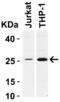 BCL2 antibody, 3337, ProSci Inc, Western Blot image 