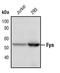 FYN Proto-Oncogene, Src Family Tyrosine Kinase antibody, PA5-17499, Invitrogen Antibodies, Western Blot image 