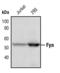 FYN Proto-Oncogene, Src Family Tyrosine Kinase antibody, PA5-17499, Invitrogen Antibodies, Western Blot image 