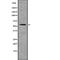 Keratin 6A antibody, abx216493, Abbexa, Western Blot image 