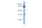 Chromosome 11 Open Reading Frame 54 antibody, PA5-42029, Invitrogen Antibodies, Western Blot image 