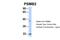 Proteasome Subunit Beta 2 antibody, 27-087, ProSci, Western Blot image 