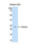 Desert Hedgehog Signaling Molecule antibody, LS-C297116, Lifespan Biosciences, Western Blot image 