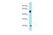 Coenzyme Q7, Hydroxylase antibody, A04682, Boster Biological Technology, Western Blot image 