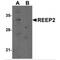 Receptor Accessory Protein 2 antibody, MBS151416, MyBioSource, Western Blot image 