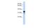 Regulator Of Microtubule Dynamics 1 antibody, GTX46469, GeneTex, Western Blot image 